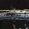 the album cover for Gilla Band - Pugnello [Black]
