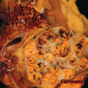 Blasted Pancreas - Carcinoma (Vinyl LP) - Pale Blue Dot Records
